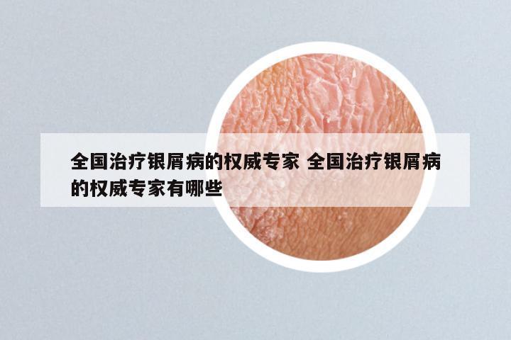 全国治疗银屑病的权威专家 全国治疗银屑病的权威专家有哪些