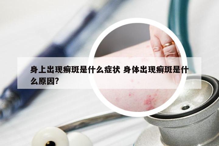 身上出现癣斑是什么症状 身体出现癣斑是什么原因?
