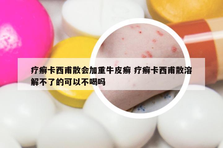 疗癣卡西甫散会加重牛皮癣 疗癣卡西甫散溶解不了的可以不喝吗