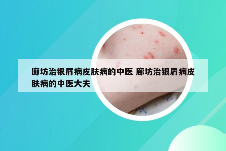 廊坊治银屑病皮肤病的中医 廊坊治银屑病皮肤病的中医大夫