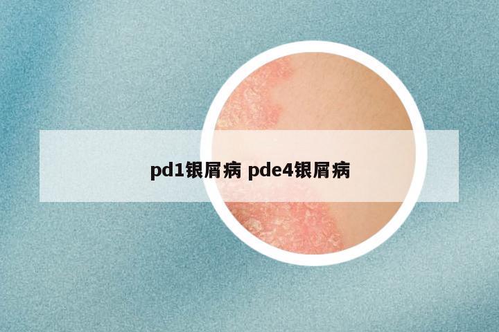pd1银屑病 pde4银屑病