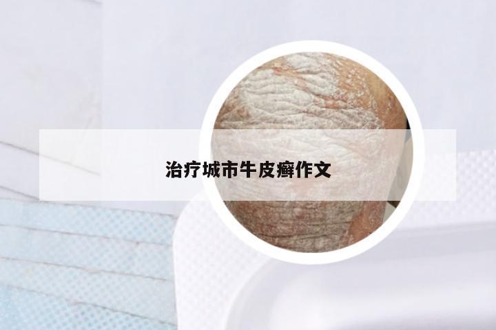 治疗城市牛皮癣作文