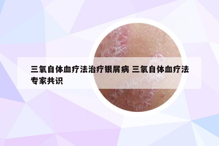 三氧自体血疗法治疗银屑病 三氧自体血疗法专家共识