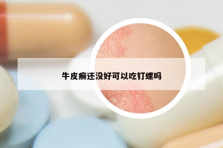 牛皮癣还没好可以吃钉螺吗