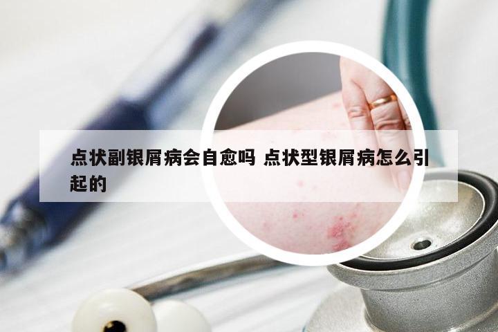 点状副银屑病会自愈吗 点状型银屑病怎么引起的