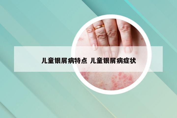 儿童银屑病特点 儿童银屑病症状