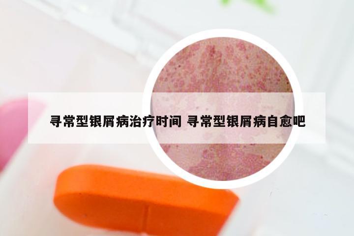 寻常型银屑病治疗时间 寻常型银屑病自愈吧