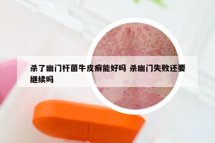 杀了幽门杆菌牛皮癣能好吗 杀幽门失败还要继续吗