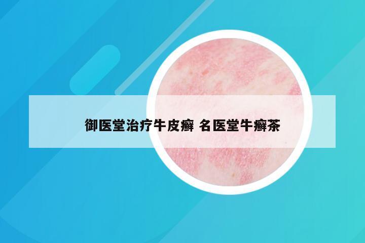御医堂治疗牛皮癣 名医堂牛癣茶