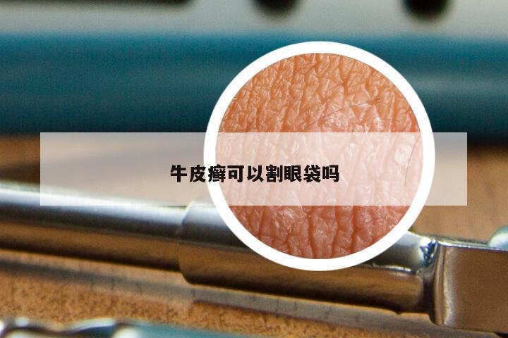 牛皮癣可以割眼袋吗