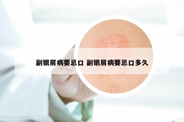 副银屑病要忌口 副银屑病要忌口多久