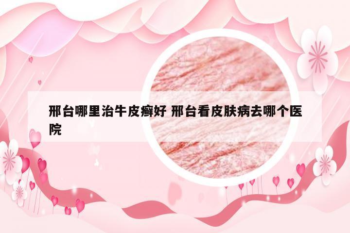 邢台哪里治牛皮癣好 邢台看皮肤病去哪个医院