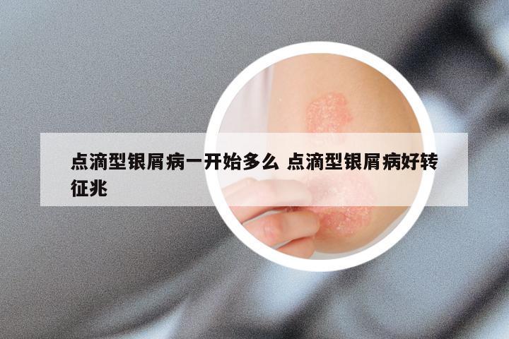 点滴型银屑病一开始多么 点滴型银屑病好转征兆