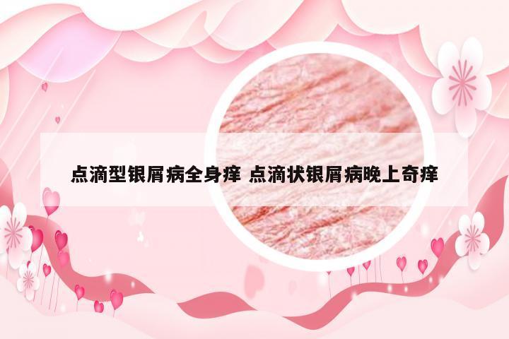 点滴型银屑病全身痒 点滴状银屑病晚上奇痒