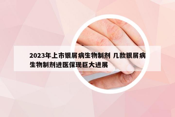 2023年上市银屑病生物制剂 几款银屑病生物制剂进医保现巨大进展