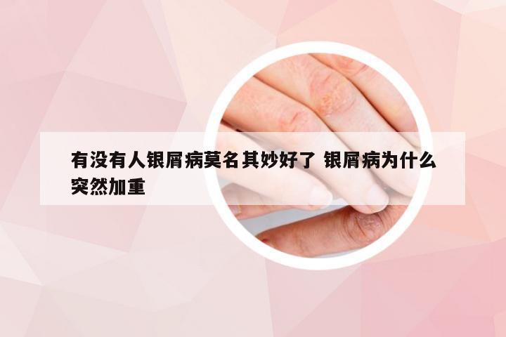 有没有人银屑病莫名其妙好了 银屑病为什么突然加重