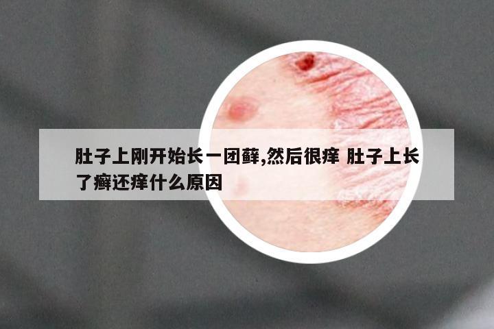 肚子上刚开始长一团藓,然后很痒 肚子上长了癣还痒什么原因