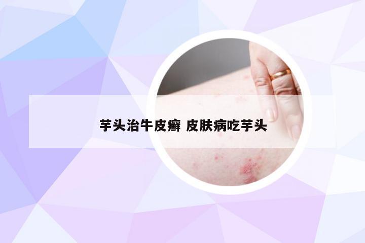 芋头治牛皮癣 皮肤病吃芋头