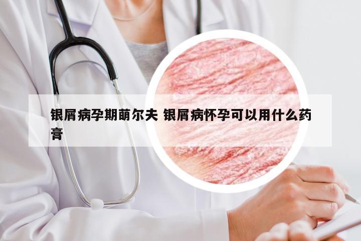 银屑病孕期萌尔夫 银屑病怀孕可以用什么药膏