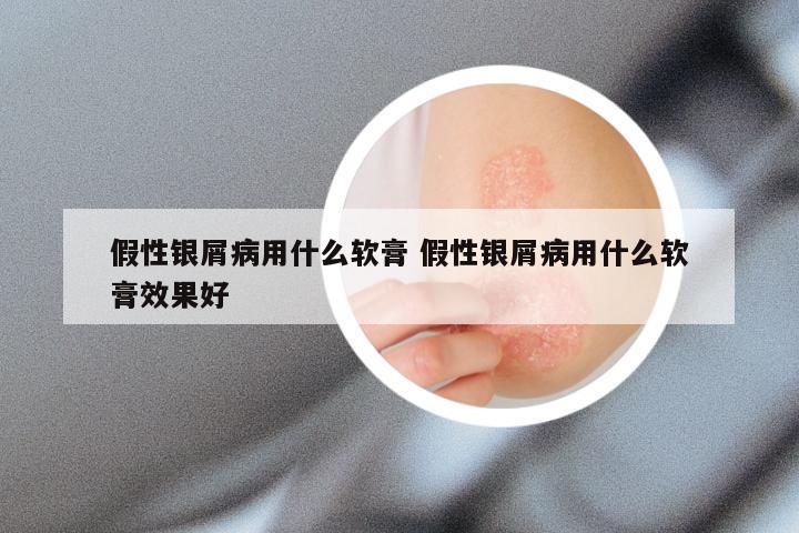 假性银屑病用什么软膏 假性银屑病用什么软膏效果好