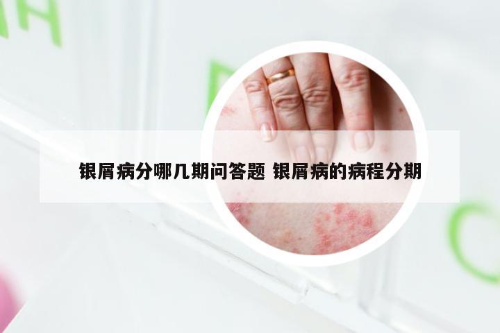 银屑病分哪几期问答题 银屑病的病程分期