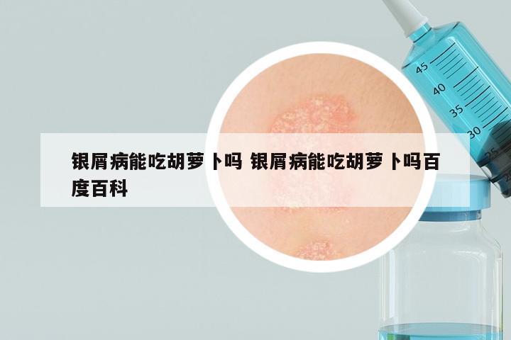 银屑病能吃胡萝卜吗 银屑病能吃胡萝卜吗百度百科