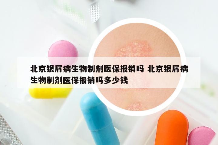 北京银屑病生物制剂医保报销吗 北京银屑病生物制剂医保报销吗多少钱