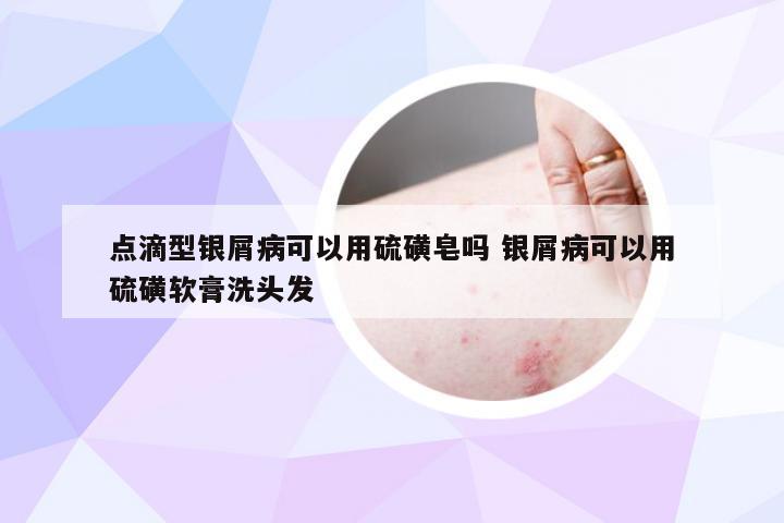 点滴型银屑病可以用硫磺皂吗 银屑病可以用硫磺软膏洗头发