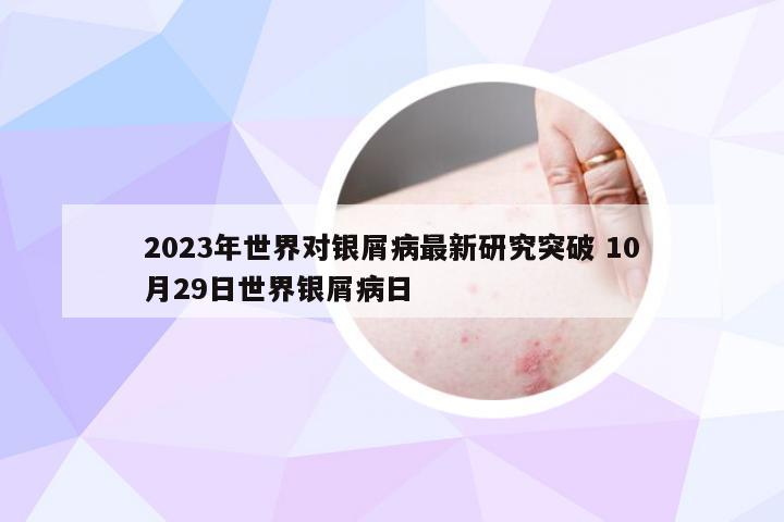 2023年世界对银屑病最新研究突破 10月29日世界银屑病日