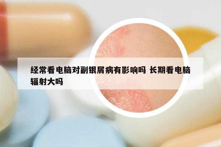 经常看电脑对副银屑病有影响吗 长期看电脑辐射大吗