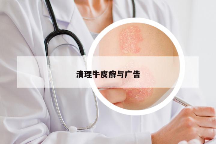 清理牛皮癣与广告