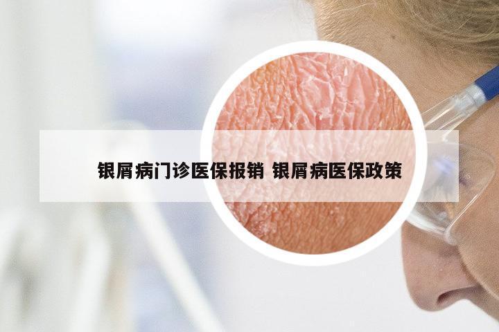 银屑病门诊医保报销 银屑病医保政策