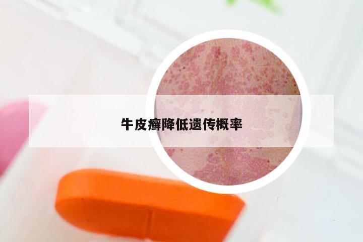 牛皮癣降低遗传概率
