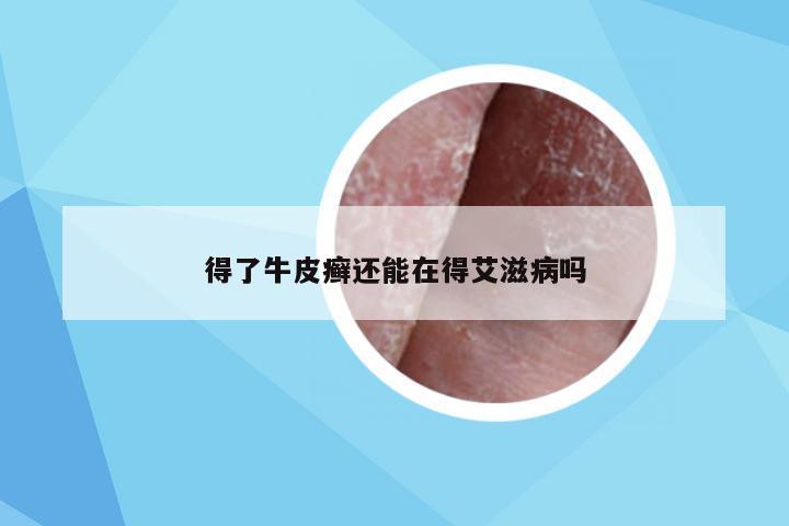 得了牛皮癣还能在得艾滋病吗