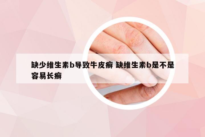 缺少维生素b导致牛皮癣 缺维生素b是不是容易长癣