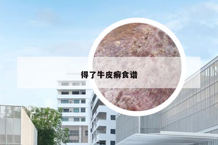 得了牛皮癣食谱