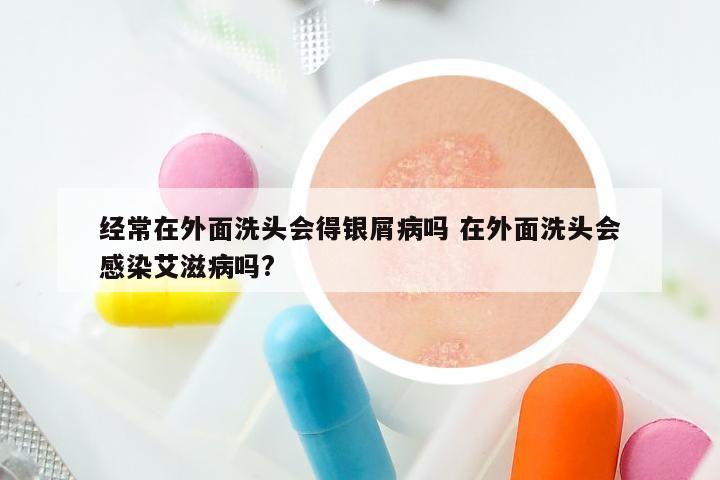 经常在外面洗头会得银屑病吗 在外面洗头会感染艾滋病吗?