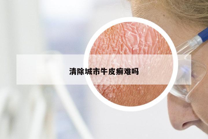 清除城市牛皮癣难吗