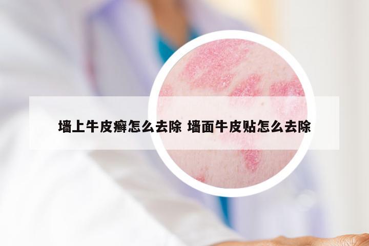 墙上牛皮癣怎么去除 墙面牛皮贴怎么去除