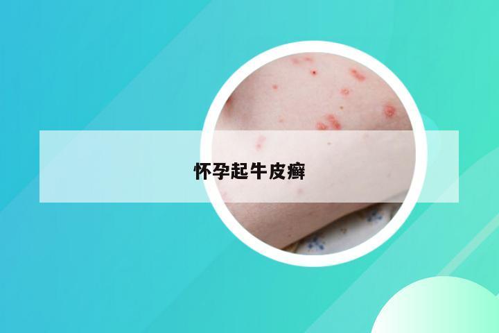 怀孕起牛皮癣