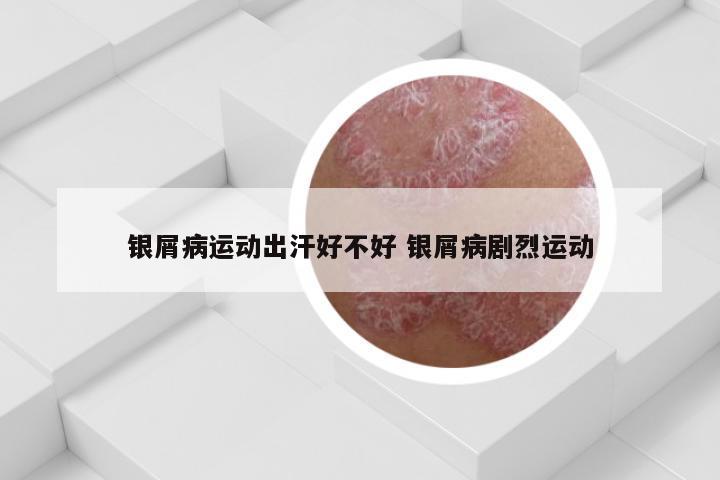 银屑病运动出汗好不好 银屑病剧烈运动