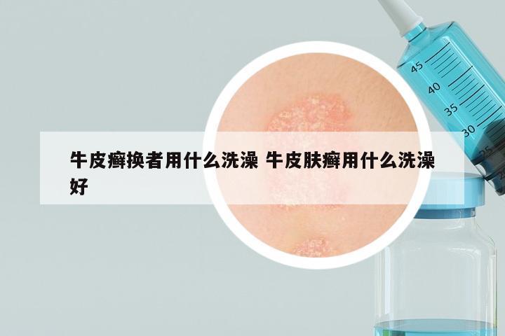 牛皮癣换者用什么洗澡 牛皮肤癣用什么洗澡好