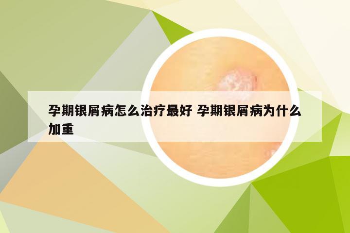 孕期银屑病怎么治疗最好 孕期银屑病为什么加重