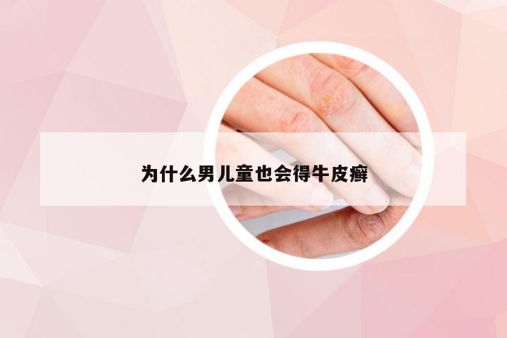 为什么男儿童也会得牛皮癣