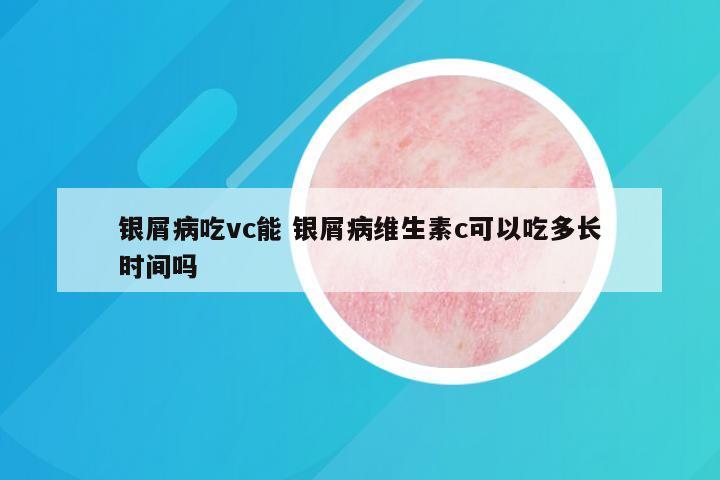 银屑病吃vc能 银屑病维生素c可以吃多长时间吗