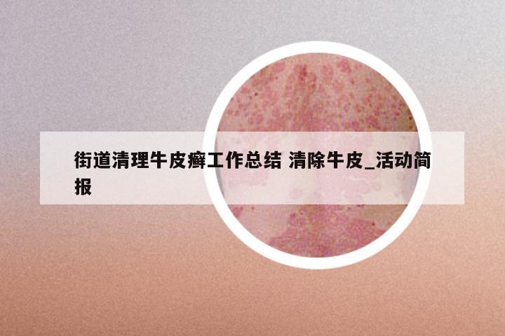 街道清理牛皮癣工作总结 清除牛皮_活动简报