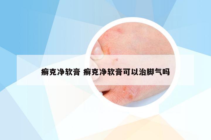 癣克净软膏 癣克净软膏可以治脚气吗