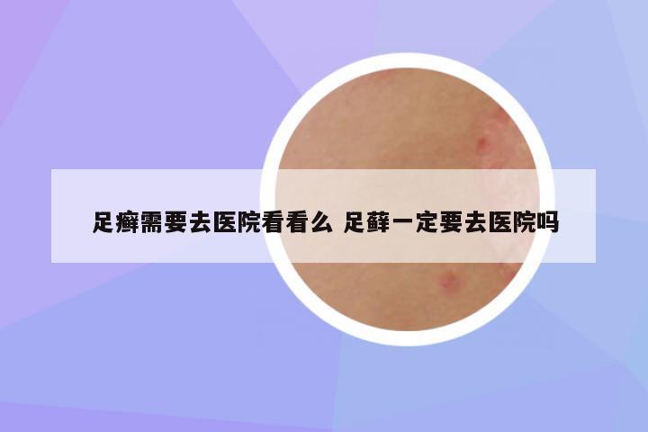 足癣需要去医院看看么 足藓一定要去医院吗