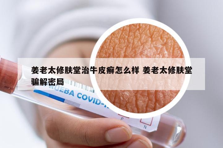 姜老太修肤堂治牛皮癣怎么样 姜老太修肤堂骗解密局