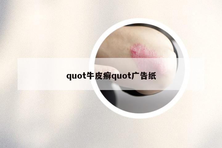 quot牛皮癣quot广告纸